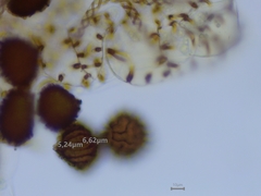 Fossombronia pusilla