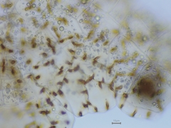 Fossombronia pusilla