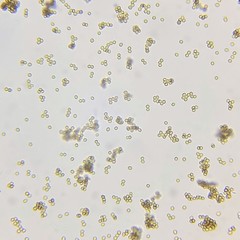 Trichoderma atroviride