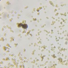 Trichoderma atroviride