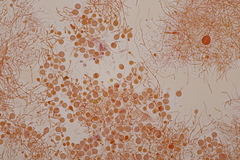 Tremella globispora
