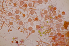 Tremella globispora