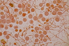 Tremella globispora