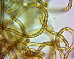 Arcyria congesta