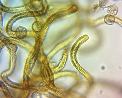 Arcyria congesta