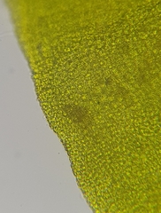 Trichostomum brachydontium