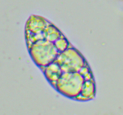 Glaucophyta