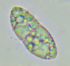 Glaucophyta