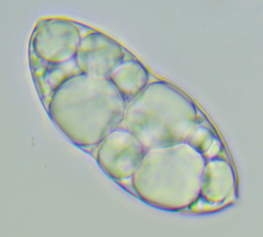 Glaucophyta