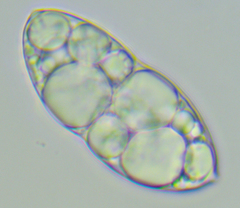Glaucophyta