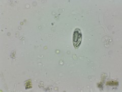 Euglenozoa