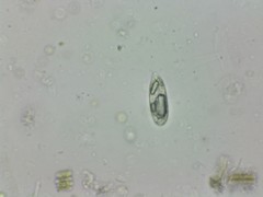 Euglenozoa