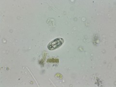 Euglenozoa
