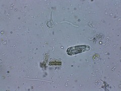 Euglenozoa