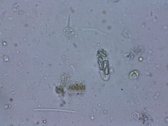 Euglenozoa
