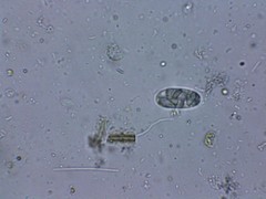 Euglenozoa