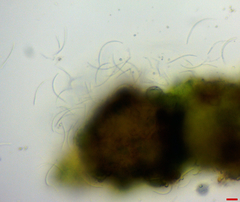 Septoria geranii