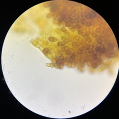 Puccinia smilacis