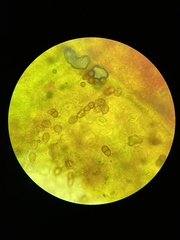 Puccinia smilacis