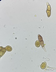Puccinia smilacis