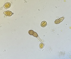 Puccinia smilacis