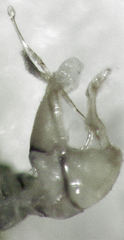 Anoeconeossa communis