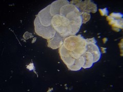 Cibicidoides variabilis