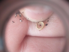 Polyzoniidae