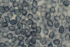 Russula cistoadelpha