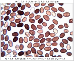 Coprinellus xanthothrix