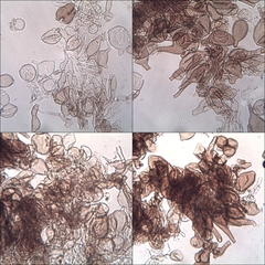 Coprinellus xanthothrix