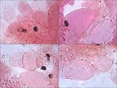 Coprinellus xanthothrix