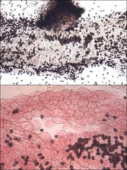 Coprinellus xanthothrix
