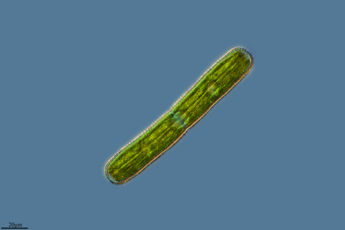 Penium margaritaceum