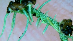 Biatoropsis usnearum