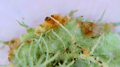 Biatoropsis usnearum