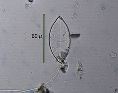 Anomoeoneis