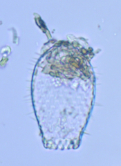 Euglyphidae