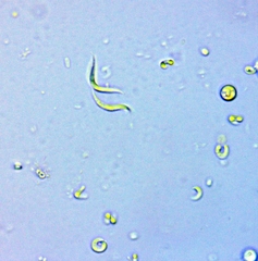 Monoraphidium contortum