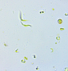 Monoraphidium contortum