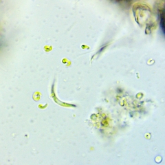 Monoraphidium contortum