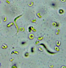 Monoraphidium contortum