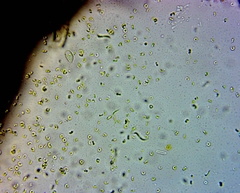 Monoraphidium contortum