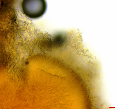 Stilbocrea macrostoma