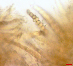 Stilbocrea macrostoma