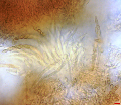 Stilbocrea macrostoma