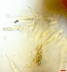 Stilbocrea macrostoma