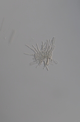 Pseudocercospora chionanthi-retusi