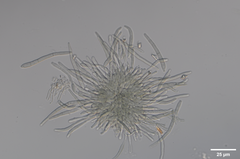 Pseudocercospora chionanthi-retusi