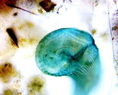 Stentor coeruleus